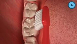 Dental Hygiene
